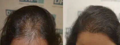 Riya T.