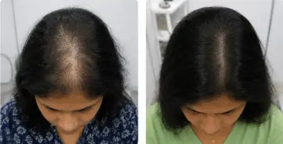 Komal T.